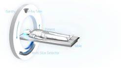 FIGURE 1. In a conventional CT scanner, an x-ray source rotates around the patient. Indirect detectors provide the data from which a 3D image is generated.